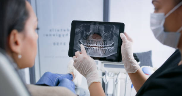 Licensed Tooth Extraction service in Big Bear City, CA - Smile Center Dentistry